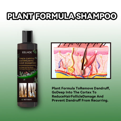 Tinea Capitis Anti-Itch Shampoo Anti-Drop Refreshing Oil Control Hair Care Anti-Dandruff Anti-Itch Shampoo - V.I.P Digital Presence