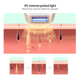 Screen 5-Speed Laser Hair Removal Device Ice-Sensing Home Full-Body Freezing Point Hair Removal Device IPL Photon Painless Hair Removal Device - V.I.P Digital Presence