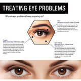 Parche de gel de aloe vera para ojos: reduce las líneas finas y las ojeras, reafirma los ojos y es antiarrugas e hidratante.