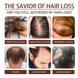 Castor Oil Hair Dense Essential Oil Repair Damaged Hair, Nourish Scalp, Strengthen Hair And Prevent Hair Loss - V.I.P Digital Presence