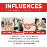 Dark Spot Whitening Cream, Lightening Yellow Brown White Spot Cream Dark Spots Correct Skin Tone Moisturize Skin Whitening - V.I.P Digital Presence