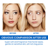 Gentle Makeup Remover Wipes Deep Cleanse Face Eye And Lip Makeup Gentle Refreshing Non-Irritating Makeup Remover Wipes - V.I.P Digital Presence