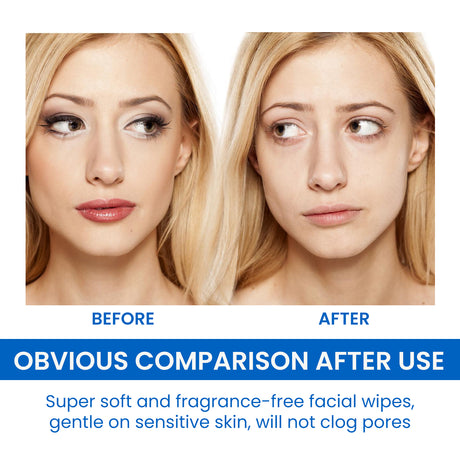 Gentle Makeup Remover Wipes Deep Cleanse Face Eye And Lip Makeup Gentle Refreshing Non-Irritating Makeup Remover Wipes - V.I.P Digital Presence