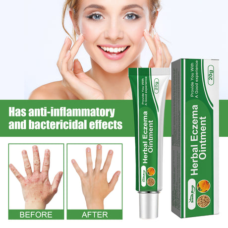 Herbal Eczema Ointment, Relieve Hand And Foot Moss Skin Redness Itchy Skin Repair Ointment - V.I.P Digital Presence