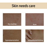 Handcrafted Body Oil, Body Massage Moisturizing Firming And Tender Skin Care Essential Oil - V.I.P Digital Presence
