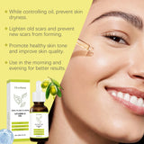 Skin Care Oil Soften And Moisturizes The Skin After Delivery And Improves The Elasticity And Luster Of The Skin - V.I.P Digital Presence