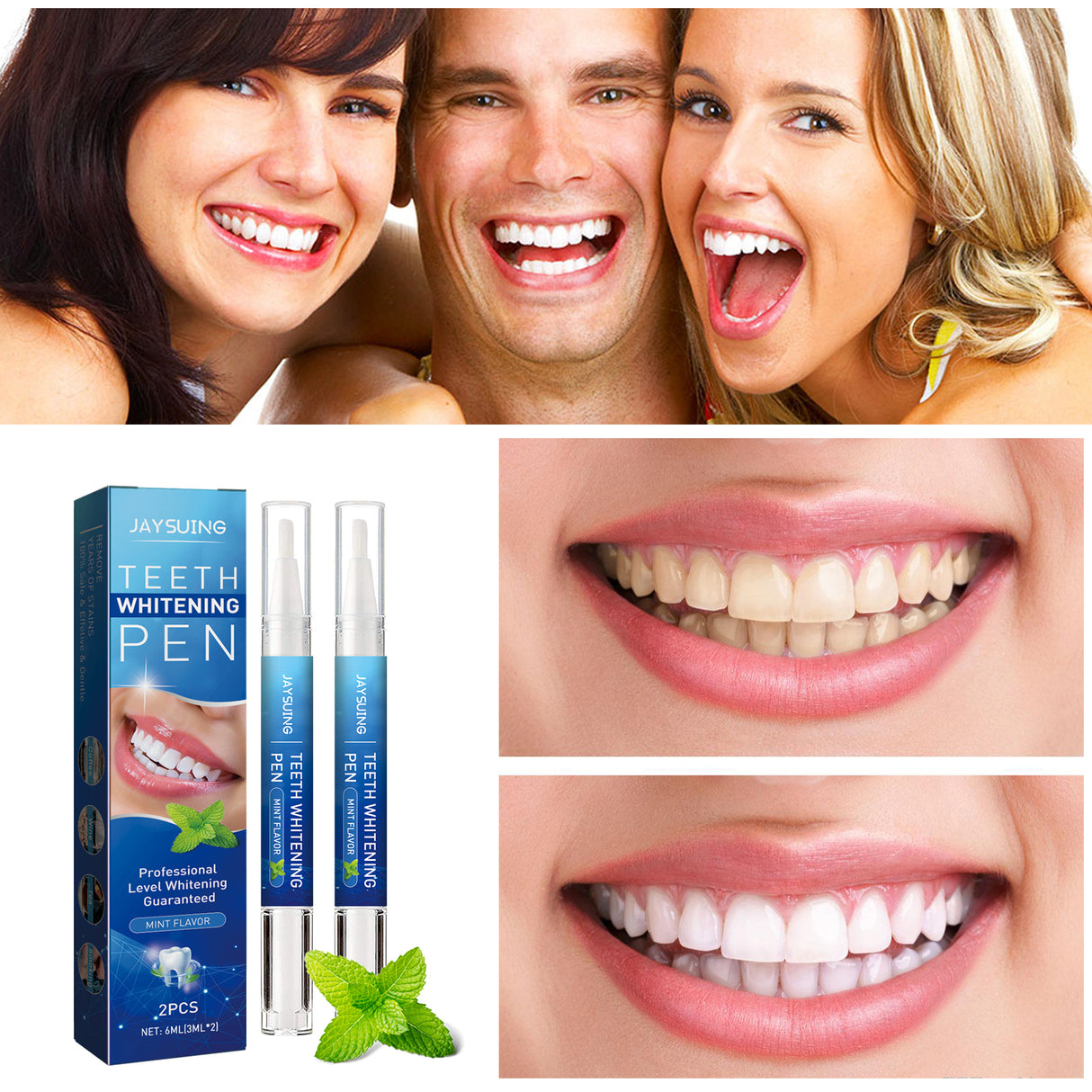Dental pencil Teeth Cleaning Remove Dirt And Yellow Smoke Teeth Brightening Whitening Oral Cleaning Pen - V.I.P Digital Presence