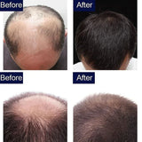 7 Day Fast Hair Growth Oil Ginger Growth Hair Treatment Anti Hair Loss Men Women Scalp Treatment Serum Products Beauty Product - V.I.P Digital Presence