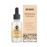 Erythematous Repair Essence, Repair Skin Lighten Facial Erythematous Moisturizing Essential Oil - V.I.P Digital Presence