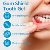 Gingival Oral Gel Pen, Clean Tooth Stains, Care For Gums, White Teeth, Oral Care Gel Pen - V.I.P Digital Presence