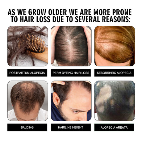 Hair Conditioning Essence, Repair Dull Smooth Hair And Scalp Massage Treatment Hair Conditioning Essence - V.I.P Digital Presence