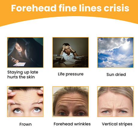 Forehead Wrinkle Patch, Lifts Lightens And Smooths Forehead Wrinkles Facial Skin Forehead Patch - V.I.P Digital Presence