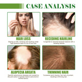 Hair Care Essential Oil Moisturizes And Protects Dry Hair, Moisturizes And Softens Hair Care Essential Oil - V.I.P Digital Presence