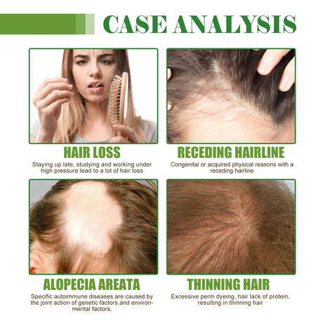 Hair Care Essential Oil Moisturizes And Protects Dry Hair, Moisturizes And Softens Hair Care Essential Oil - V.I.P Digital Presence