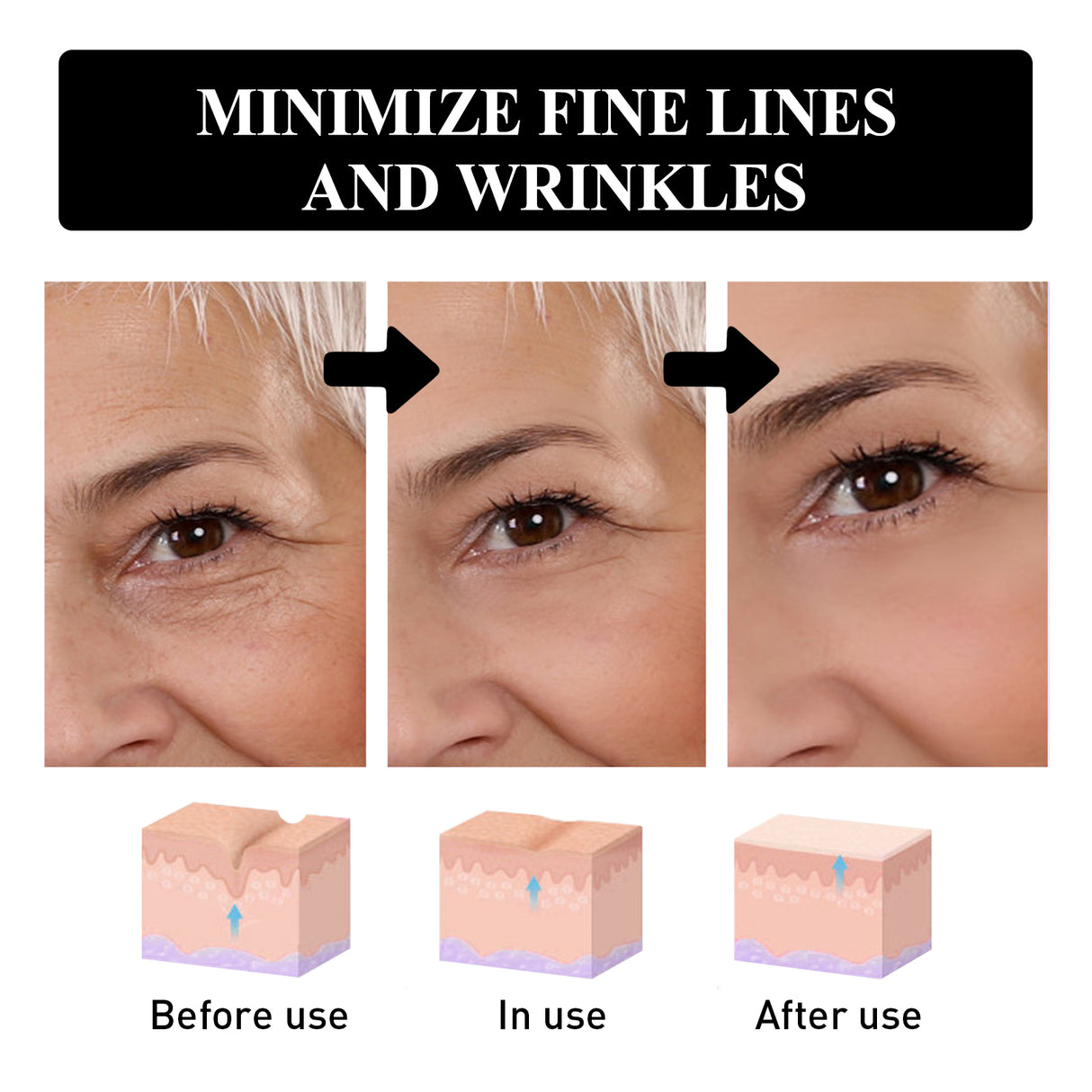 Eye Firming And Lifting Cream Moisturizes And Relieves Dry Lines, Hydrates And Improves Fine Lines - V.I.P Digital Presence