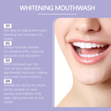 Purple Dental Mouthwash, Gentle Ingredients To Protect Teeth Clean Stains Left Fresh Smell - V.I.P Digital Presence