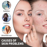 Dark Spot Serum, Fade Spot Moisturize Skin Repair Blain Mark Face Dull Shine Essence - V.I.P Digital Presence