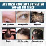 Hair Essence Spray, Prevent Hair Loss Repair Hair Dry And Frizzy Moisture And Dense Hair Essence - V.I.P Digital Presence