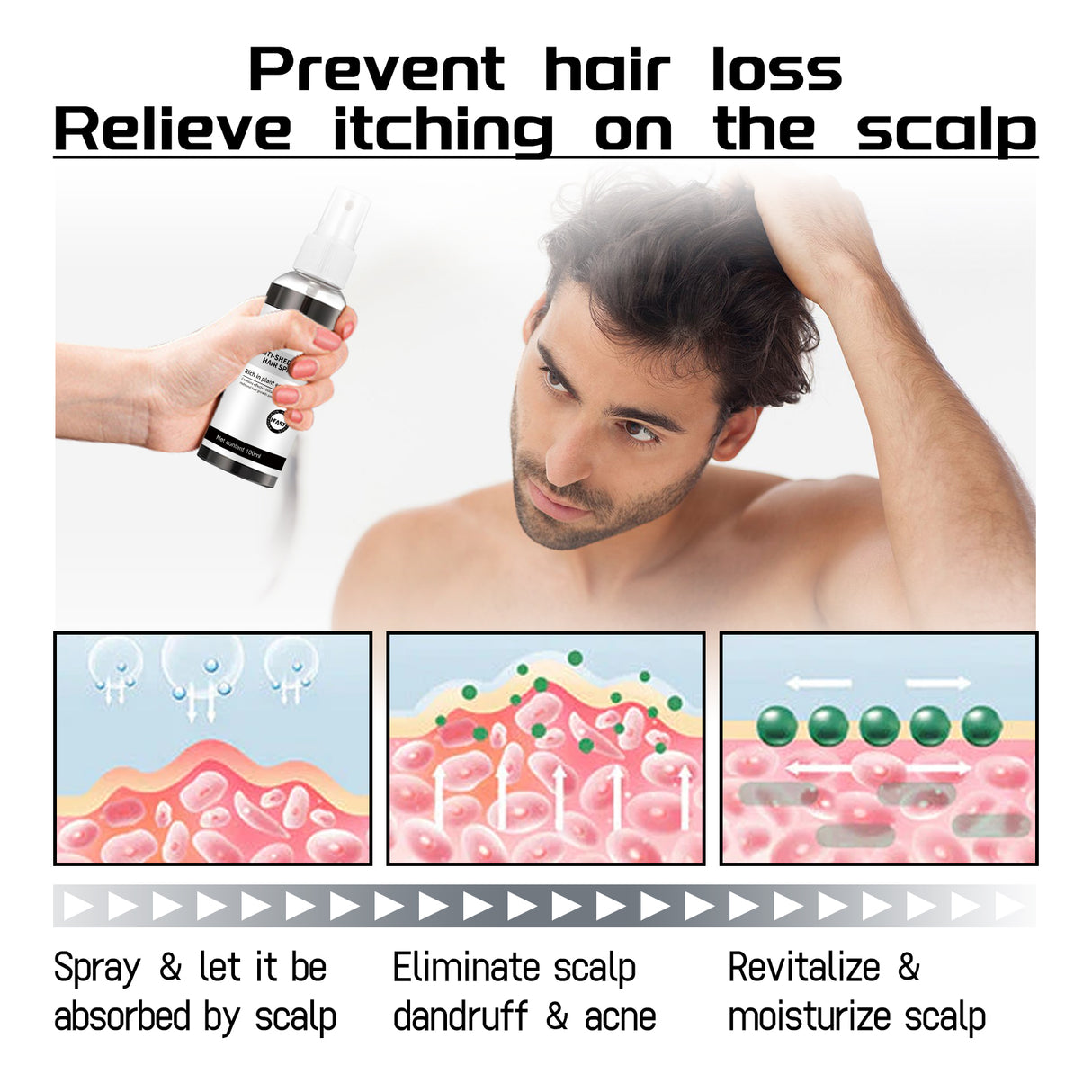 West & Month Anti-Shedding Hair Spray, Improve The Hairline Hair Hair Nutrition Moisture Hair Roots - V.I.P Digital Presence
