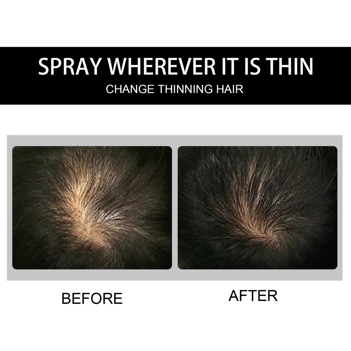 Dense Hair Fiber Powder, Increased Hair Fiber Dense Hair Beauty Hair Plant Fiber Powder - V.I.P Digital Presence