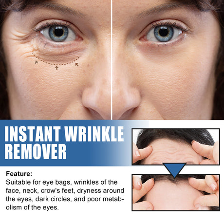 5 Seconds Retinol Cream To Reduce Fine Lines Under Eyes Hydrating Moisturizing Cream To Soften Skin - V.I.P Digital Presence
