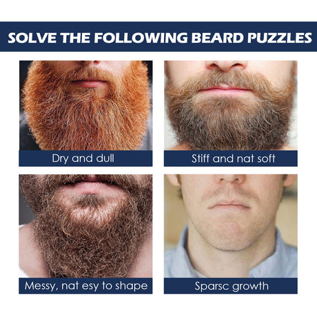 Facial Hair Care Oil Strengthens Root And Moisturizes And Brightens Men's Facial Hair - V.I.P Digital Presence