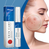 Acne Care Pen, Gently Clean Acne And Acne Closing Skin Daily Care Solution - V.I.P Digital Presence