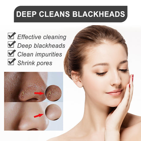 Blackhead Cleansing Cream Skin Oil Blackheads Acne Exfoliating Cleansing Repair Pore Tearing Nose Patch - V.I.P Digital Presence