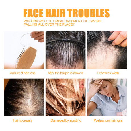 Ginger Juice Moisturizes Hair, Moisturizing And Repairing Hair Follicle Hair Strong Anti-Shampoos - V.I.P Digital Presence
