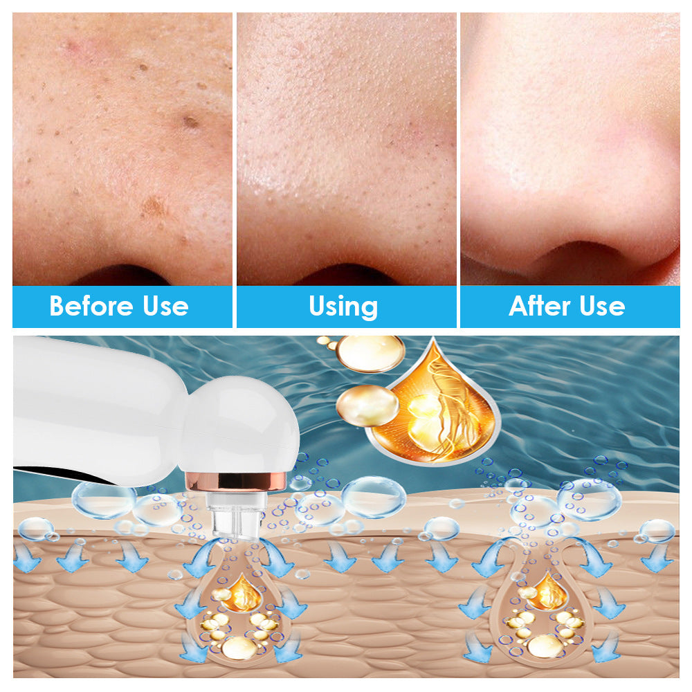New Hailicare Small Bubble Suction Blackhead Instrument Skin Pore Cleaner Water Oxygen Circulation Skin Cleaning Instrument - V.I.P Digital Presence