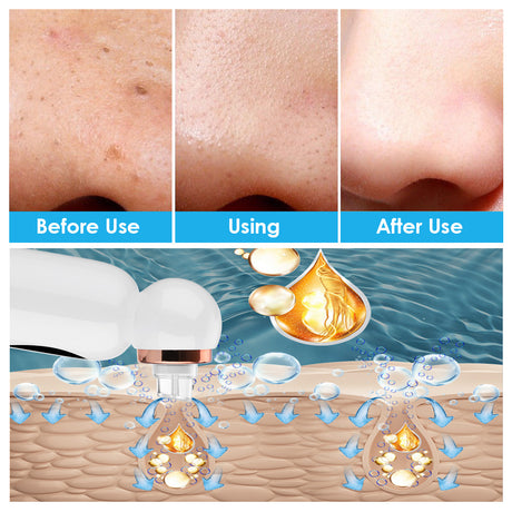 New Hailicare Small Bubble Suction Blackhead Instrument Skin Pore Cleaner Water Oxygen Circulation Skin Cleaning Instrument - V.I.P Digital Presence
