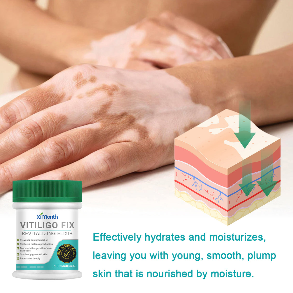 Vitiligo Fix Revitalizing Elixir, Lighten Skin Spots Even Skin Tone Moisturizing Body Care Repair Cream - V.I.P Digital Presence