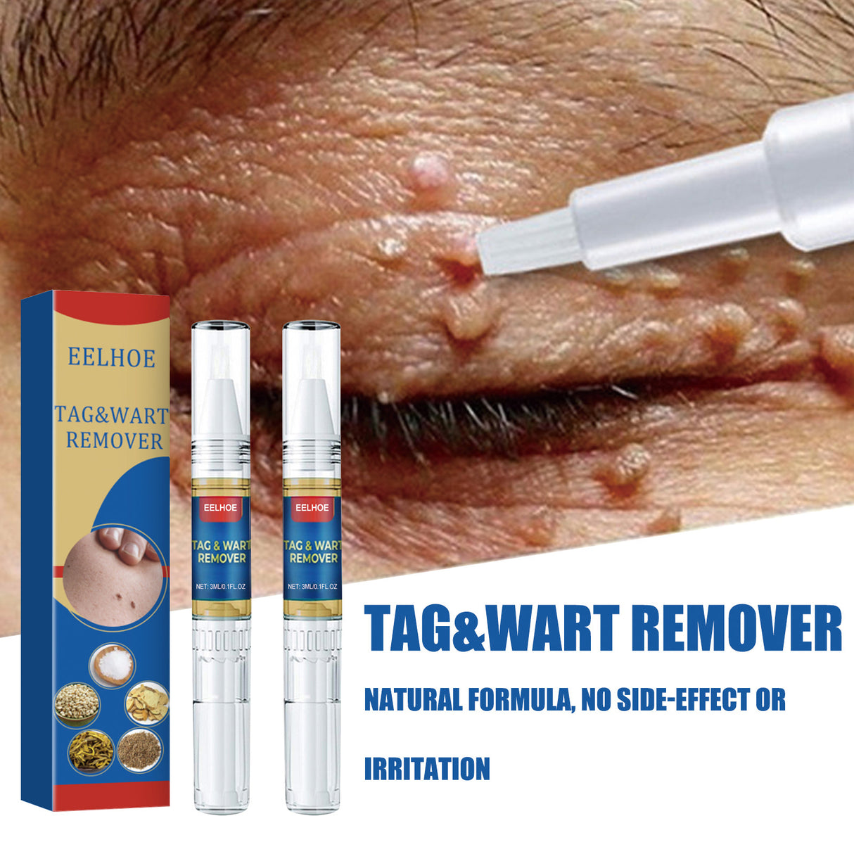Skin Kayo Pen Gentle Body Tag Remover Cleansing Skin Care Pen
