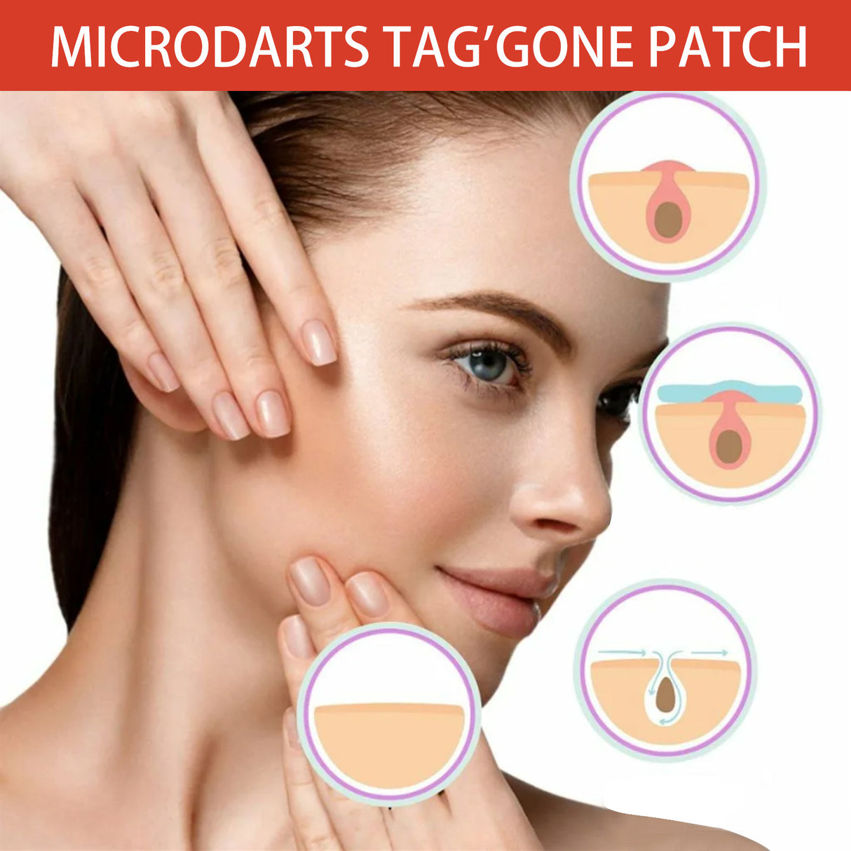 Acne Patch, Skin Clean Acne Pimple Moles Gram Wart Corns Spot Patch - V.I.P Digital Presence
