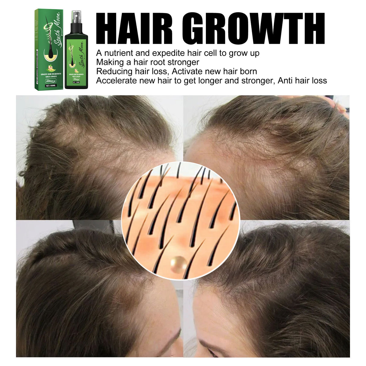 Hair Care Spray Nourishing And Nourishing Hair Massage Repair Hair And Scalp Care Solution - V.I.P Digital Presence