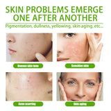Crema facial en gel que aclara manchas y líneas finas, repara enrojecimiento y poros delicados, crema facial hidratante suave.