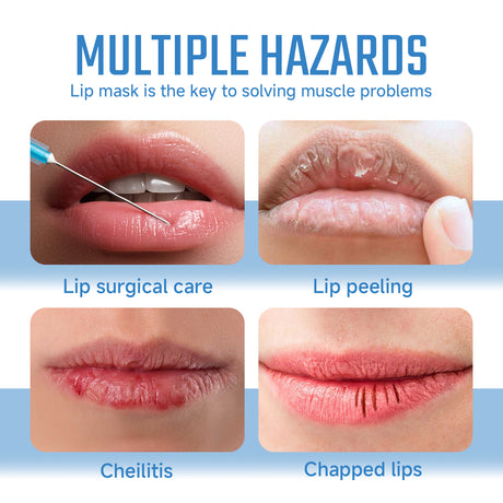Collagen Lip Mask For Lip Protection Against Dry Cracks Fade Lip Lines And Dead Skin Moisture Lip Mask - V.I.P Digital Presence