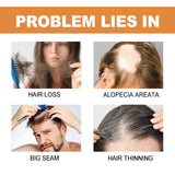 Mypa Ampoule, Strengthen And Repair Hair, Prevent Hair Loss, Strengthen Hair Root And Thicken Hair And Scalp Massage Solution - V.I.P Digital Presence