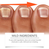 Nail Care Lotion Cleanses And Moisturizes Nails And Nails With A Gentle Conditioning Solution