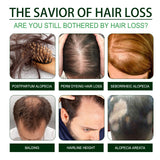 Black Castor Oil, Thickening Hair Repair Soft Massage Scalp To Strengthen Hair Strands - V.I.P Digital Presence