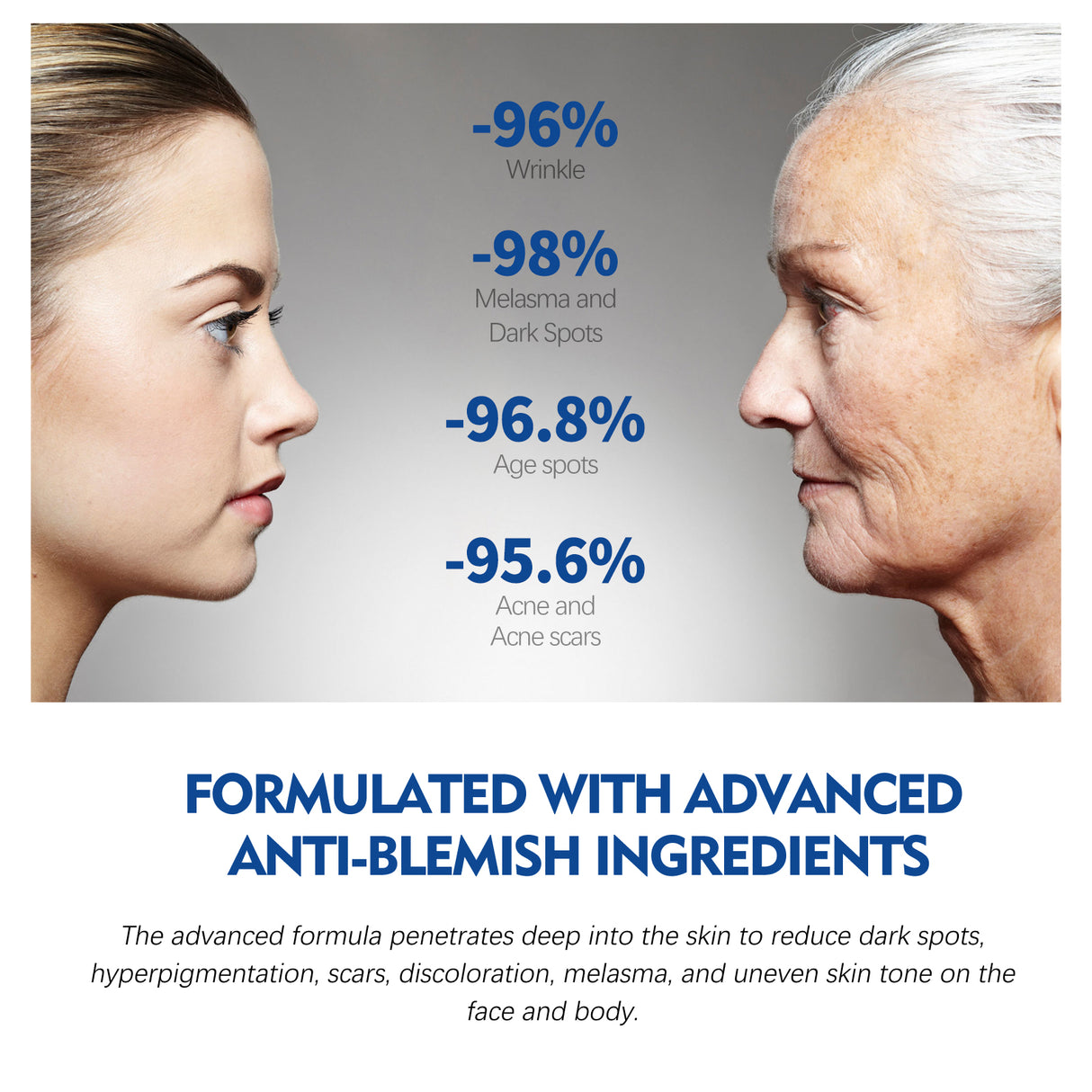 Dark Spot Repair Essence, Repair Acne Pimple Lightening Spot Fine Lines Moisturizing Firming Whitening Essence - V.I.P Digital Presence