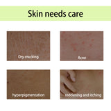 Handcrafted Body Oil, Moist Curing Firming Skin Relief Fatigue Plant Aroma Aromatic Therapy Oil - V.I.P Digital Presence
