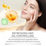 Face Essence Improve Acne Muscle Acne Closing Gentle Cleansing Face Skin Face Essence - V.I.P Digital Presence