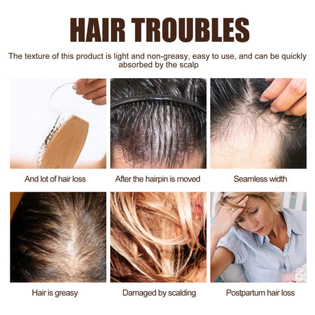 Hair Enrichment Essence, Moisturizes Hair Repair Hair Root Thickening Hairline Strengthening Hair Treatment Essence - V.I.P Digital Presence