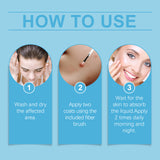 Keyu Liquid Hand And Foot Skin Especially Moles Cleansing Repair Smooth Skin Skin Label Care Liquid - V.I.P Digital Presence