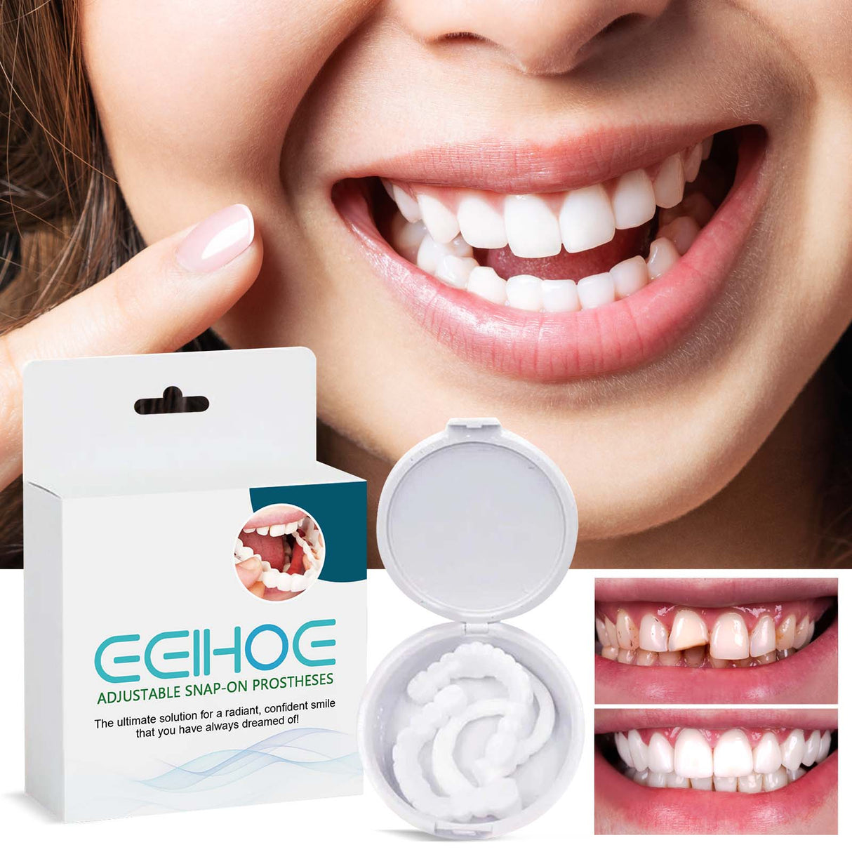 Adjustable Buckle Dentures, Modified Teeth Interdental Set Orthodontic Dentures Set - V.I.P Digital Presence
