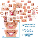 Teeth Whitening Pen Clean Beauty Brightening Gel Mouth Clean Yellow Teeth Tea Stains Smoke Stains Clean Teeth Stains Clean - V.I.P Digital Presence