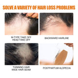 Hair Growth Spray, Men Hair And Beard Thickening Strengthening Anti-loss Care Solution - V.I.P Digital Presence