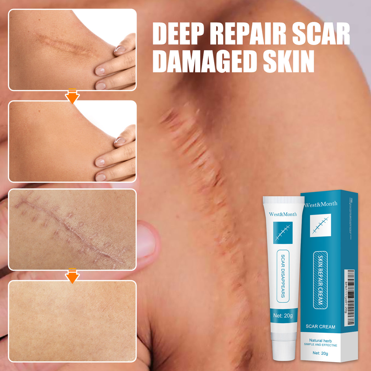 Skin Repair Cream Gentle Moisturizing Hydrating Moisturizing Repair Skin Care Repair Cream - V.I.P Digital Presence