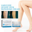 Varicose Spider Vein Repairing Cream, Relief Leg Pain Earthworm Leg Veins Care Massage Cream - V.I.P Digital Presence
